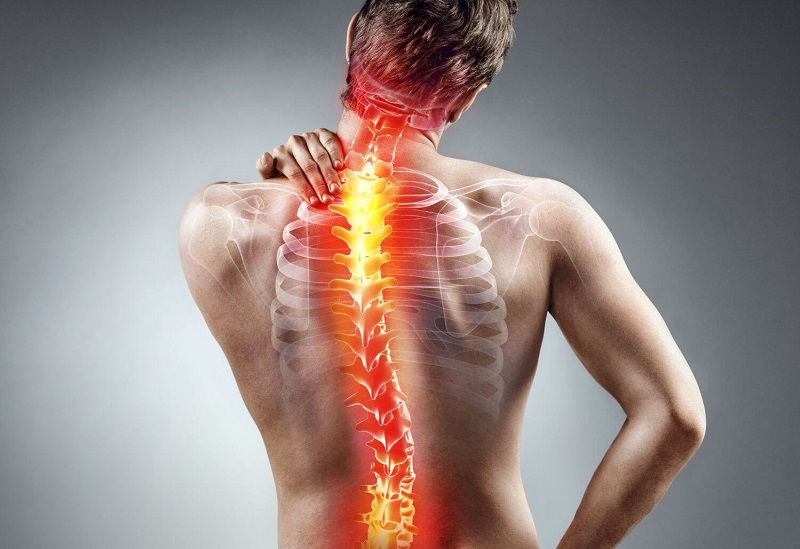 Thoái hóa đốt sống lưng chèn dây thần kinh biểu hiện ra sao?