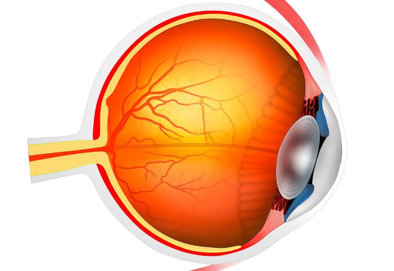 Lão thị là một hiện tượng tự nhiên của quá trình lão hóa, liên quan chặt chẽ đến sự thay đổi cấu trúc nhãn cầu.