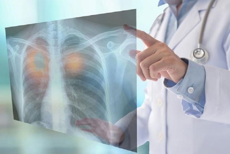 điều trị bệnh