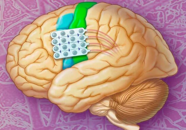 Điều trị, quản lý cơn co giật do bệnh động kinh