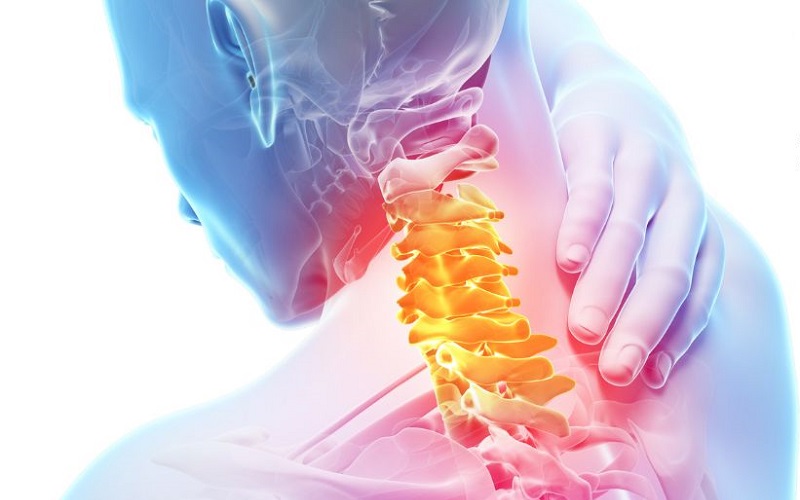 Những điều cần biết về căn bệnh thoát vị đĩa đệm cột sống cổ