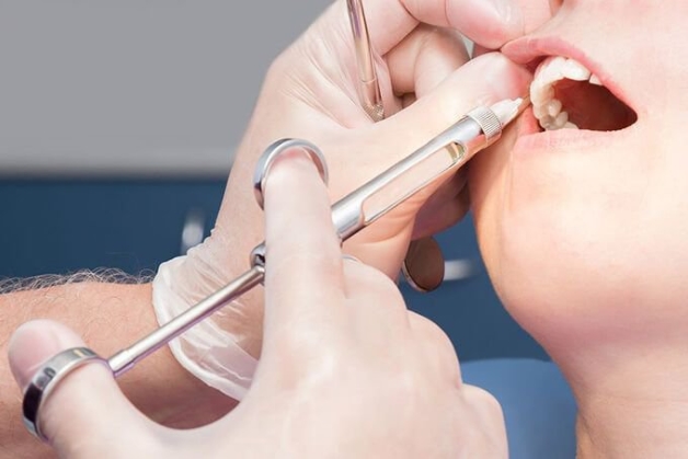 Thực hiện trồng răng có đau không