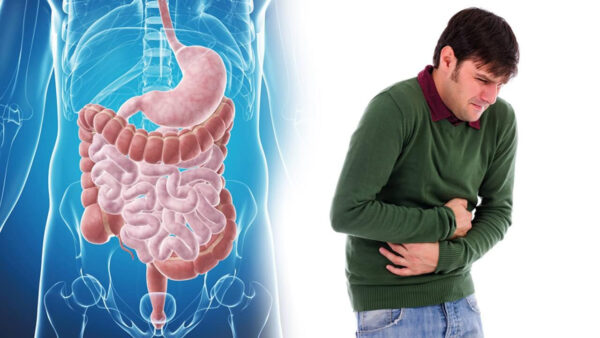 Triệu chứng hội chứng viêm ruột kích thích