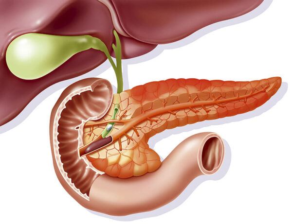 Cơ chế gây viêm tụy cấp