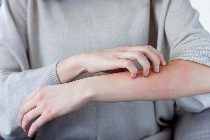 Medrol 16mg có công dụng gì?