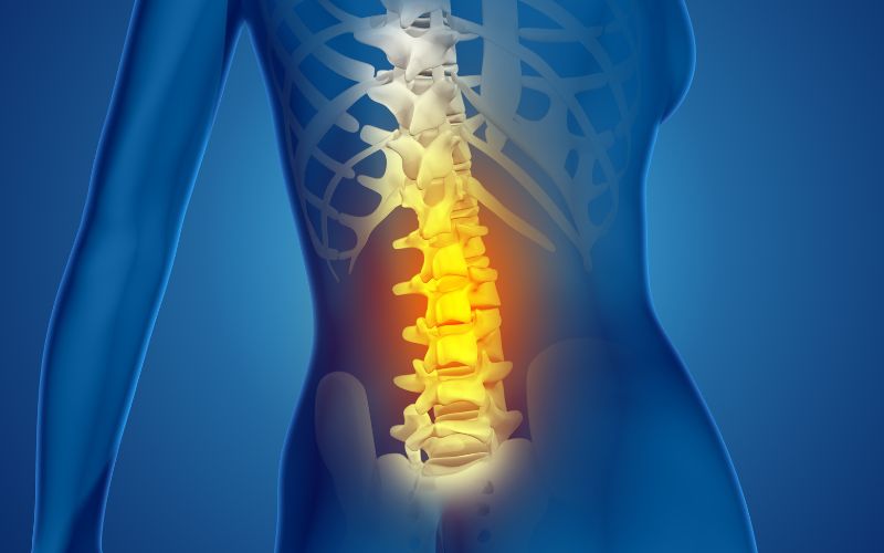 Thoái hoá đốt sống lưng là tình trạng thoái hoá của các đĩa đệm đốt sống.