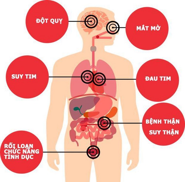 Bệnh huyết áp nếu không được điều trị kịp thời có thể gây những biến chứng nguy hiểm.