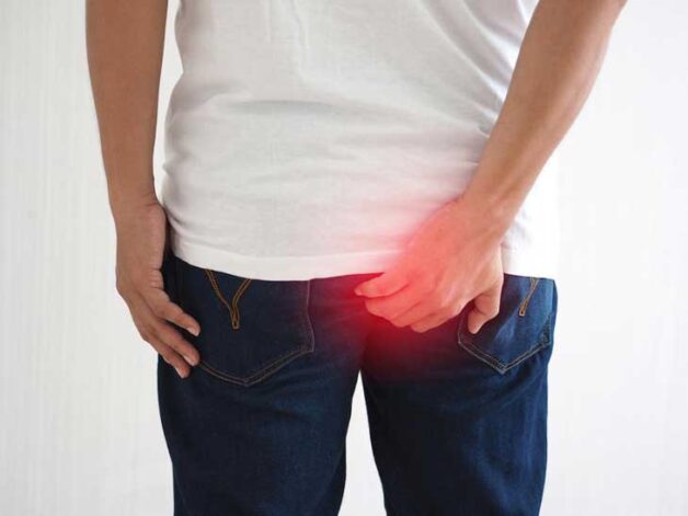 Bệnh trĩ gây đau đớn và khó chịu cho người bệnh
