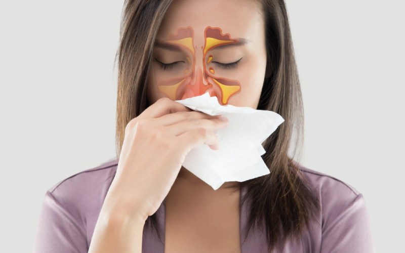 Dùng thuốc điều trị viêm mũi dị ứng kéo dài có nhờn thuốc không