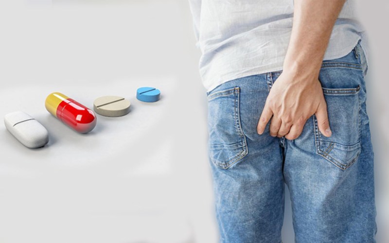 lưu ý dùng thuốc chữa bệnh trĩ