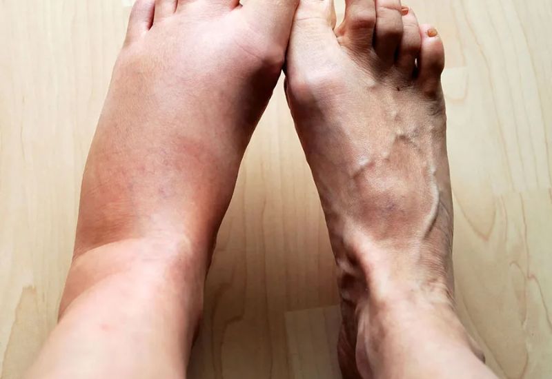 Thành phần và công dụng của thuốc Katrypsin