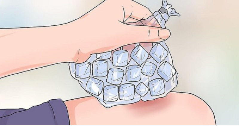 cách tan vết bầm