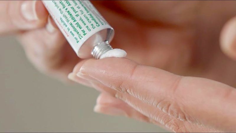 các loại thuốc bôi muỗi đốt