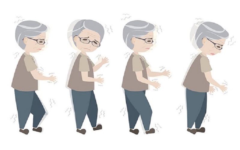 bệnh parkinson