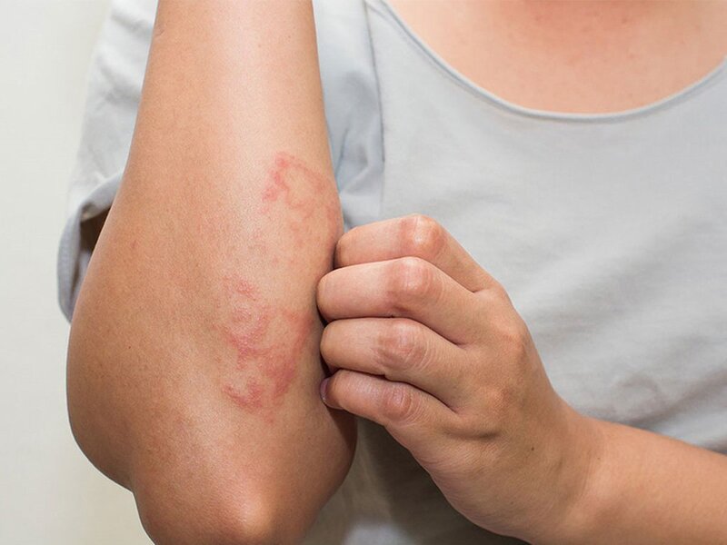 Một số bệnh về da có thể được điều trị bằng kháng sinh.