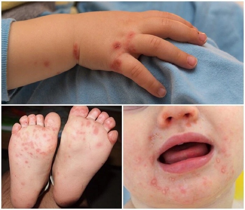 Có rất nhiều bệnh có thể gây ra những biến chứng vô cùng nguy hiểm cho trẻ.