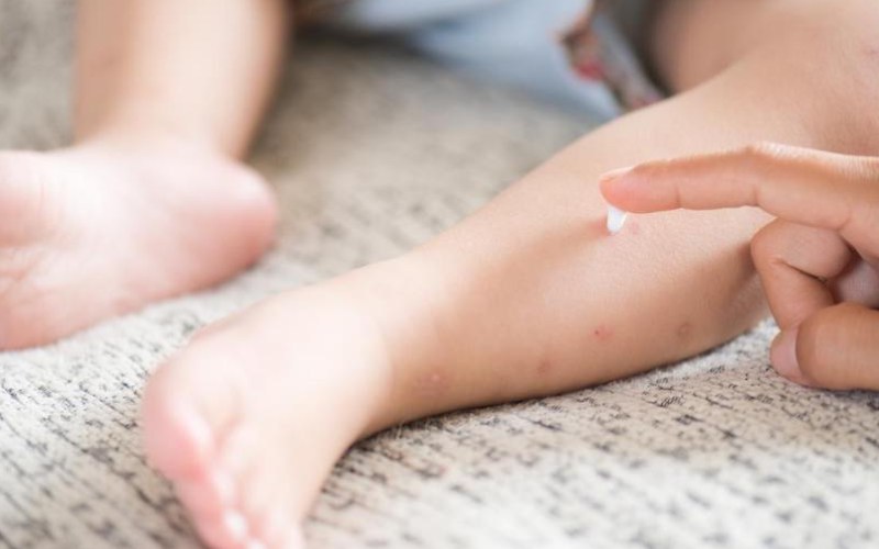 thuốc bôi ngoài da trị ngứa cho trẻ em
