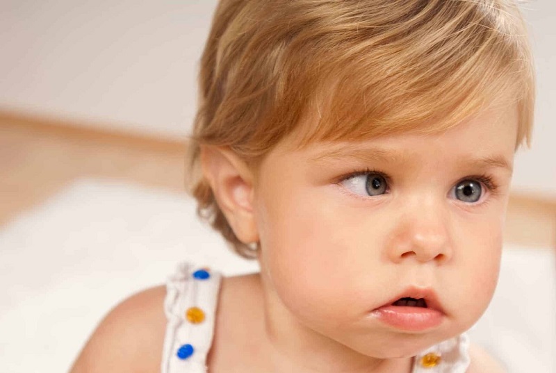 Nên điều trị lác từ sớm