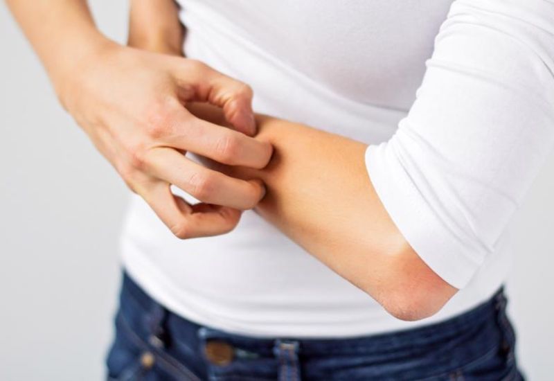 Một số trường hợp phổ biến mà Phenergan Cream có thể được chỉ định sử dụng