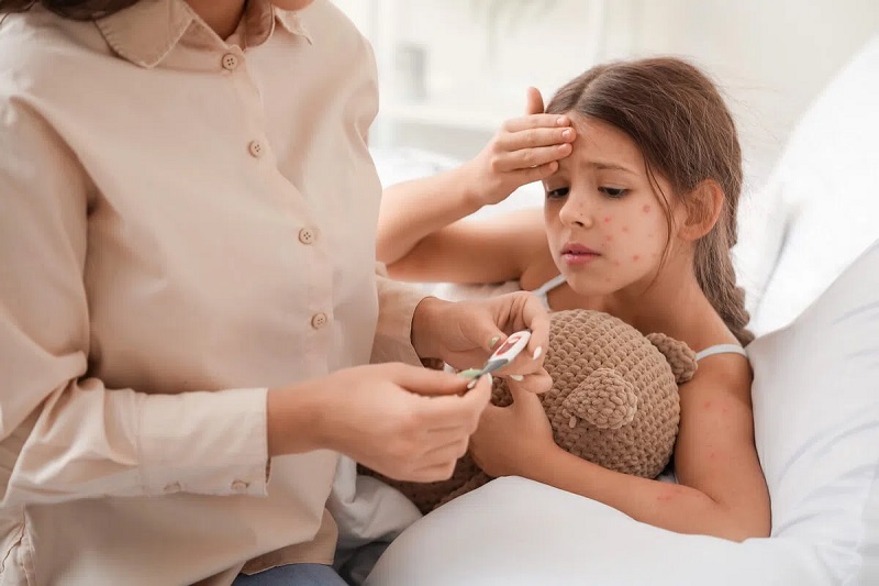 có thể dùng paracetamol trong trường hợp trẻ sốt trên 38,5 độ do thủy đậu