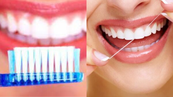 bọc răng sứ 2 răng cửa
