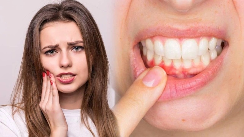 tìm địa chỉ kem đánh răng tẩy cao răng