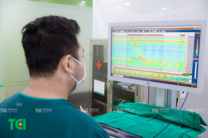 Đo áp lực nhu động thực quản (HRM) là một kỹ thuật y khoa hiện đại, hỗ trợ phân tích chi tiết chức năng của thực quản