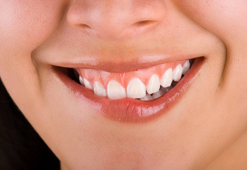 Phẫu thuật cắt lợi là một thủ thuật nha khoa được thực hiện để cải thiện sự cân bằng giữa lợi và răng, tạo sự hài hòa cho nụ cười.