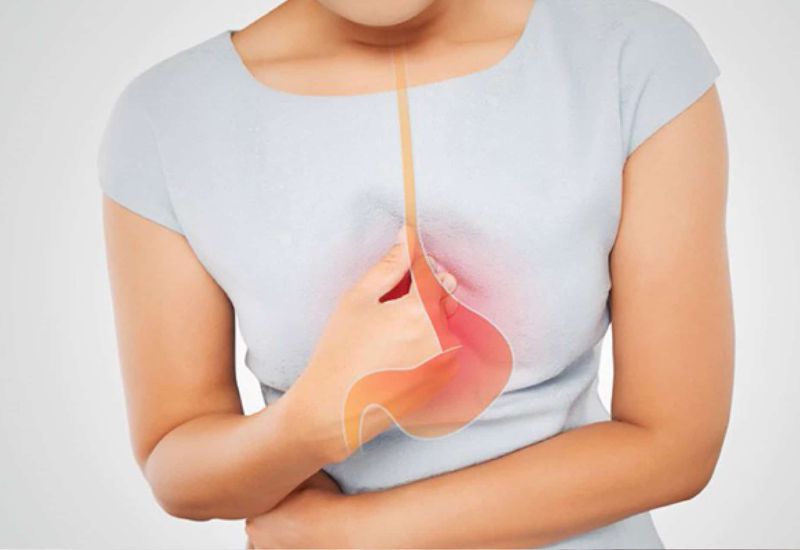 Trào ngược dạ dày thực quản và biểu hiện của bệnh