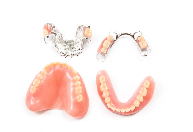 Phương pháp hàm giả tháo lắp là giải pháp thay thế răng mất phổ biến, đặc biệt hữu ích cho những người mất nhiều hoặc toàn bộ răng.