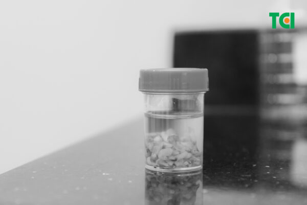 Khối u vú được loại bỏ nhẹ nhàng sau 30 phút, không gây đau đớn.
