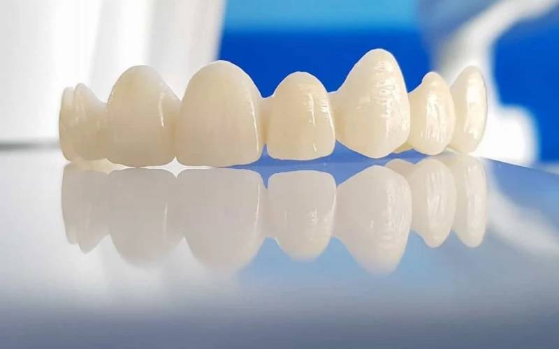 tư vấn 1 cái răng sứ bao nhiêu tiền
