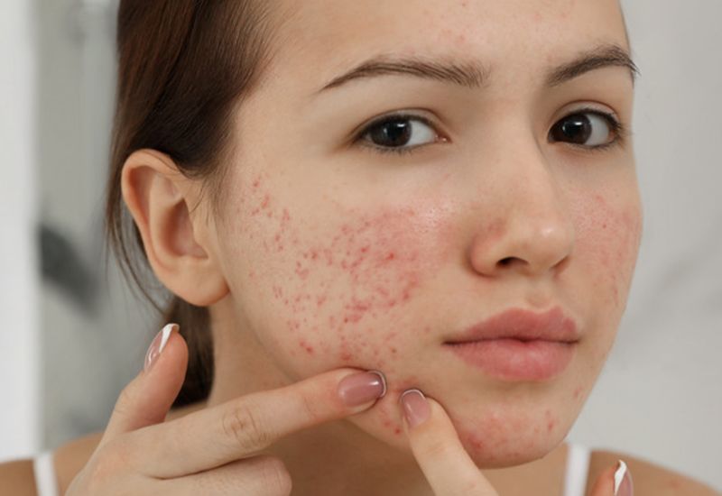 ngăn ngừa áp xe tự vỡ
