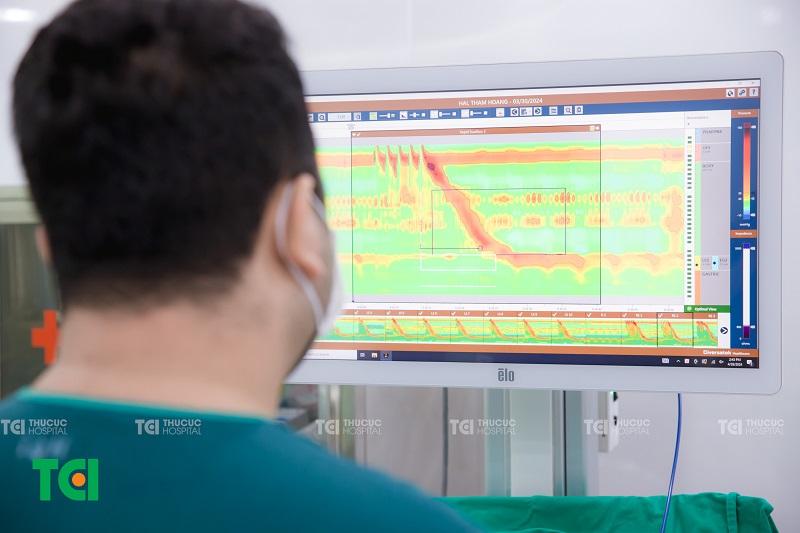 Phương pháp chẩn đoán nuốt vướng rát họng