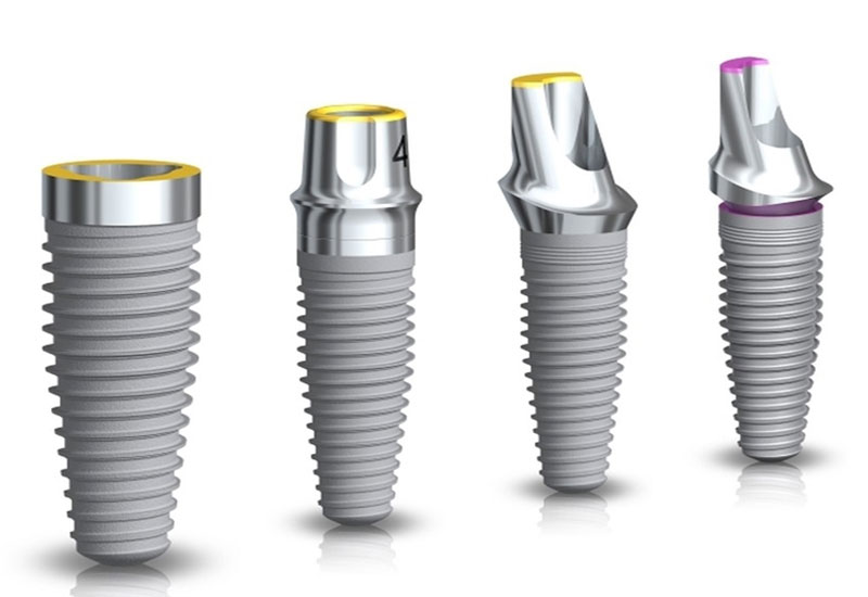 Cấy ghép răng Implant bao nhiêu tiền tại bệnh viện