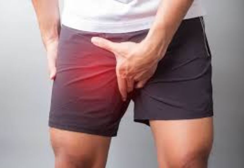 biểu hiện khi bị thoát vị bẹn