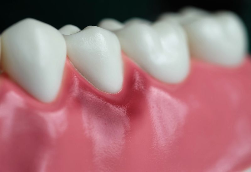 Nha sĩ thiếu kinh nghiệm dùng dụng cụ nha khoa không hiện đại tại các phòng khám nha khoa không uy tín có thể làm tổn thương răng và nướu.
