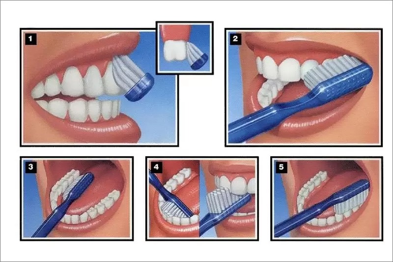 Thuốc bôi trị viêm nướu răng hằng ngày