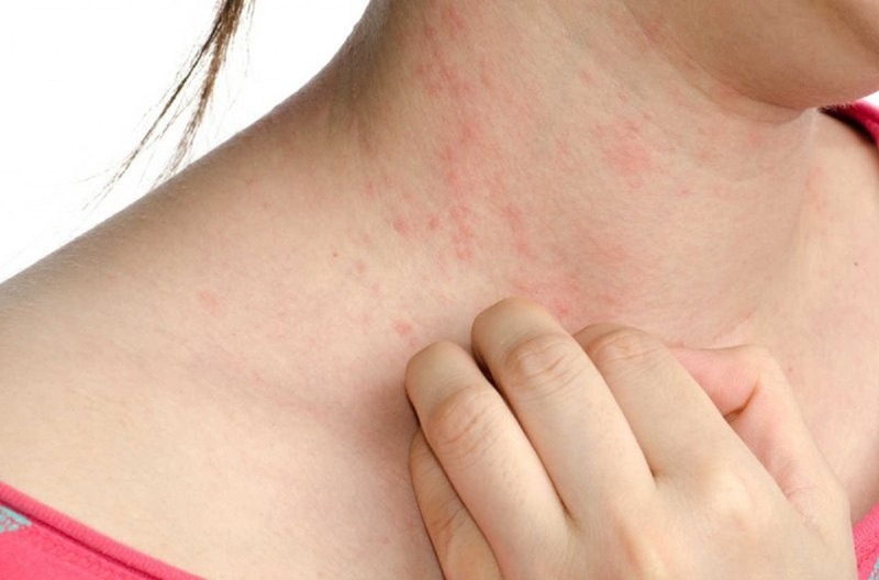 Ciprofloxacin có tác dụng phục không