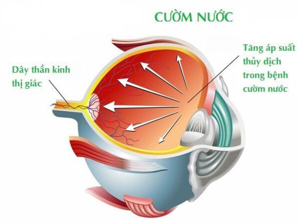Triệu chứng của bệnh diễn ra từ từ nên thường khó nhận biết ngay.