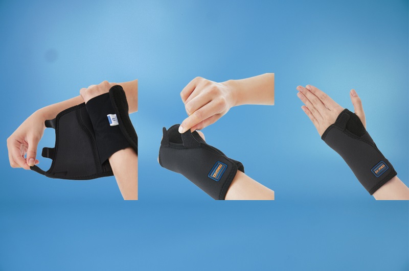 Nẹp cổ tay có thể cải thiện tình trạng bệnh
