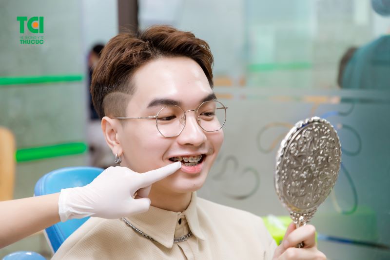 niềng răng ở hà nội