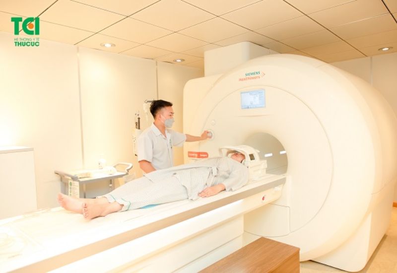 chẩn đoán dị dạng mạch máu não