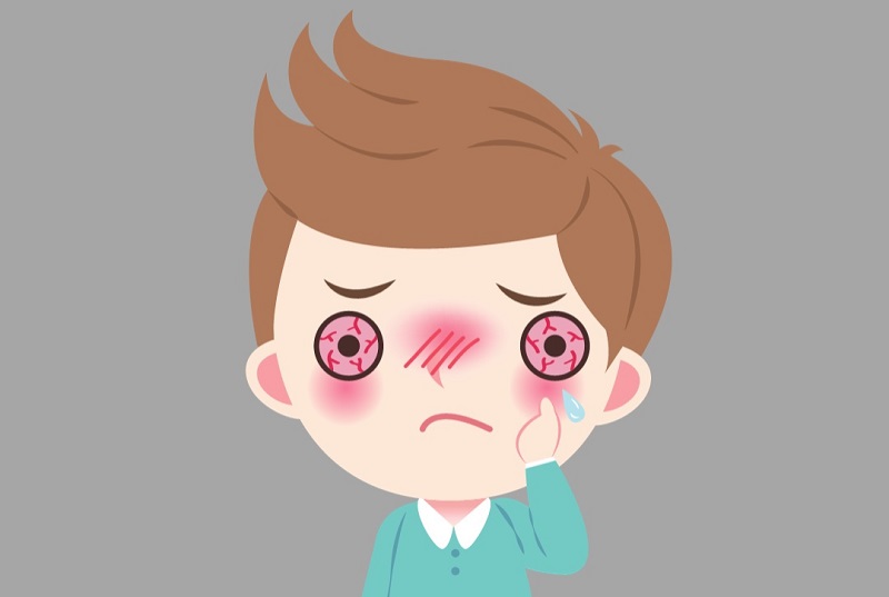 Vì sao nhiều trẻ em bị đau mắt đỏ trong mùa mưa lũ?