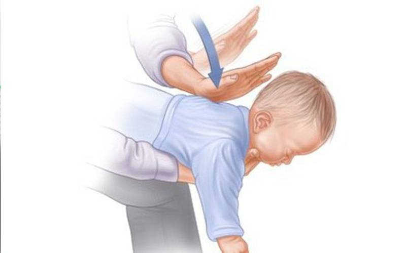 chữa hóc xương bằng sơ cứu