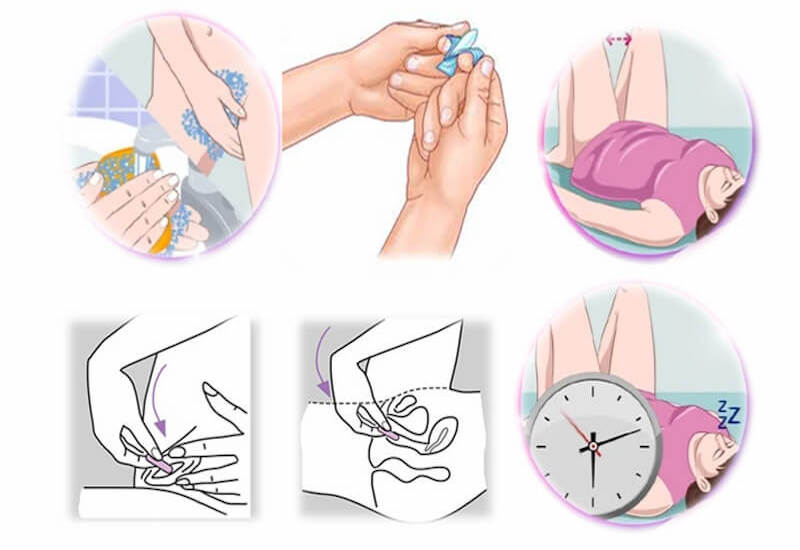 RA BÃ SAU KHI ĐẶT THUỐC PHỤ KHOA LÀ HIỆN TƯỢNG THUỐC TAN RA VÀ ĐẨY VI KHUẨN RA NGOÀI CƠ THỂ
