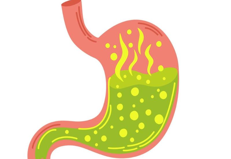 Ợ chua nấc cụt liên tục có phải là dấu hiệu của GERD?