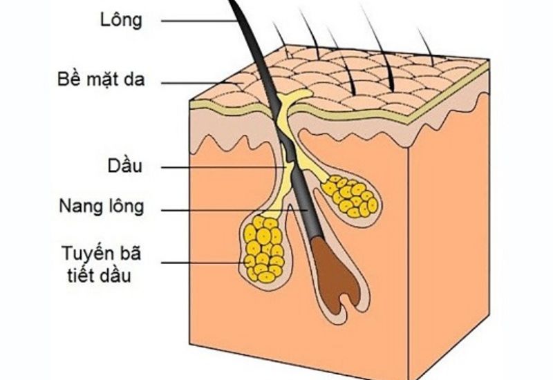 Nguyên nhân hình thành và cách mổ u bã đậu