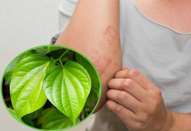 cẩn trọng với mẹo chữa u bã đậu bằng lá trầu không 