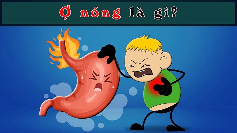 Ợ nóng là tình trạng gì?
